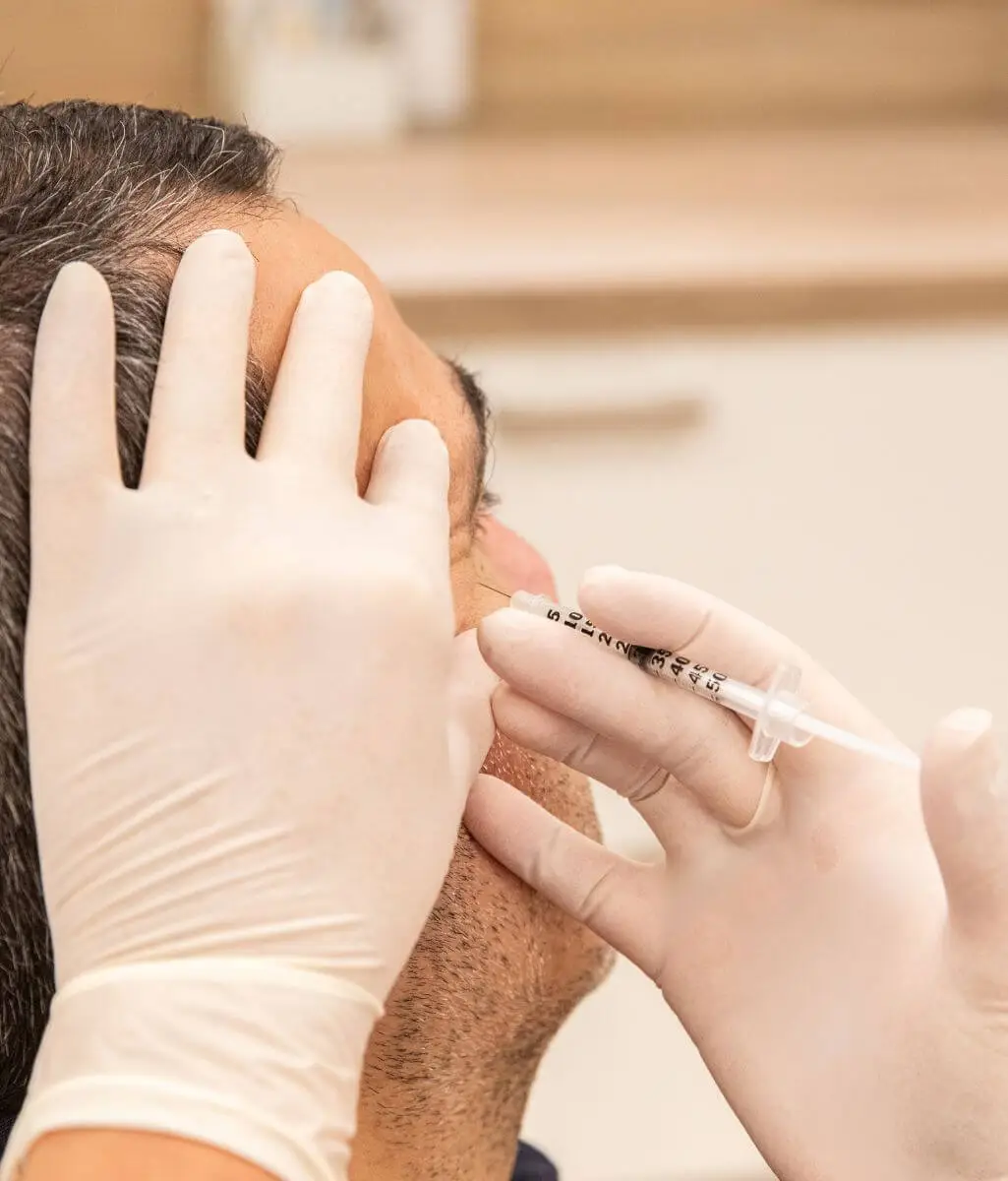 Vrouw krijgt een filler behandeling bij LocalPure Clinics in Udenhout
